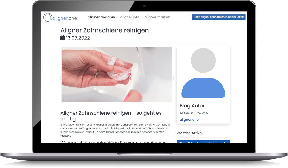 aligner marketing Gastbeitrag mit Backlink